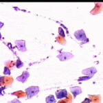 Εικόνα 3 στις 4.11.2004